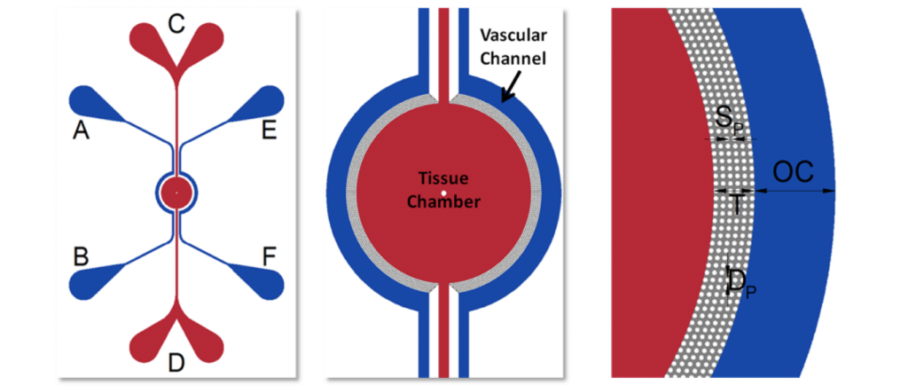 IMN2 radial chip