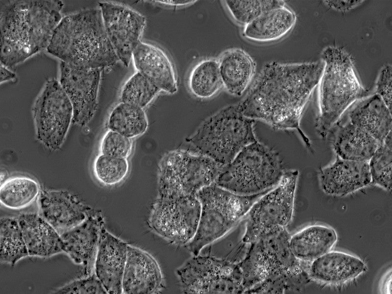 HeLa cells phase contrast 40x